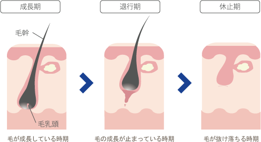 発毛と脱毛のサイクルに合わせて照射